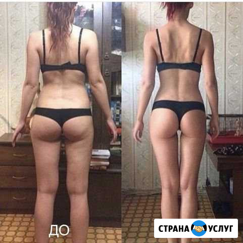 Массаж антицеллюлитный ваакумный Москва - изображение 1