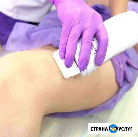Шугаринг Рыльск