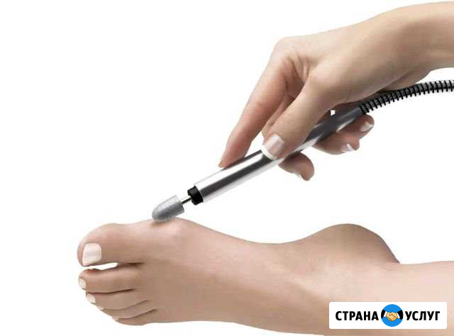 Аппаратный педикюр Рославль - изображение 1