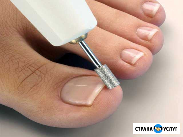Медицинский педикюр Санкт-Петербург - изображение 1