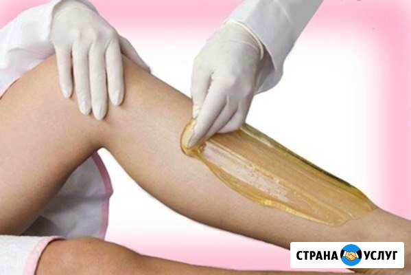 Шугаринг с выездом на дом Дедовск - изображение 1
