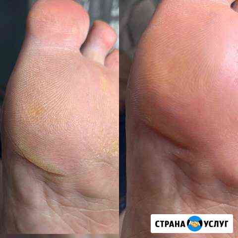Мастер педикюра Таганрог