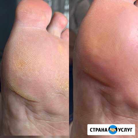 Мастер педикюра Таганрог - изображение 1