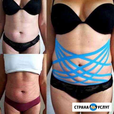 Кинезиотейпирование, массаж Красноярск