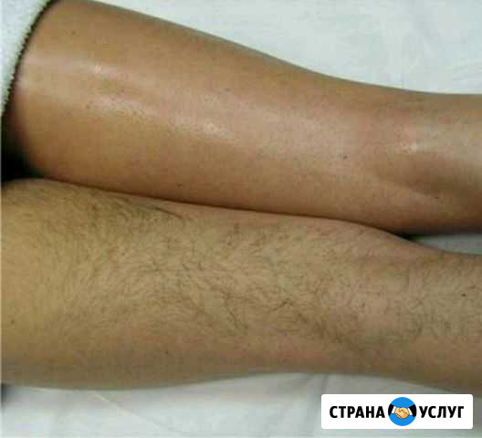 Шугаринг. Выезд специалиста на дом Каргасок - изображение 1