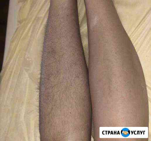 Шугаринг Владикавказ