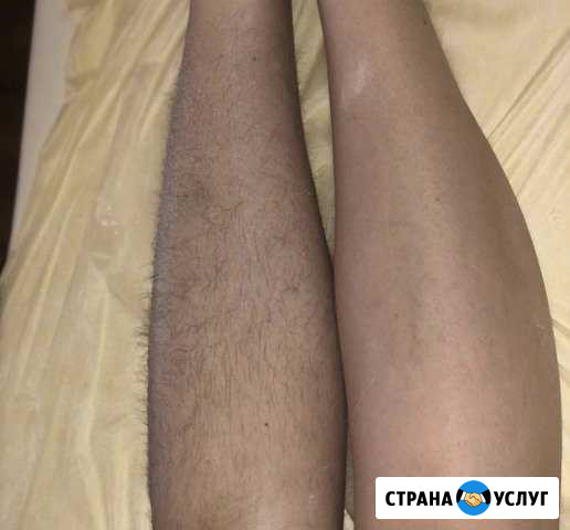 Шугаринг Владикавказ - изображение 1