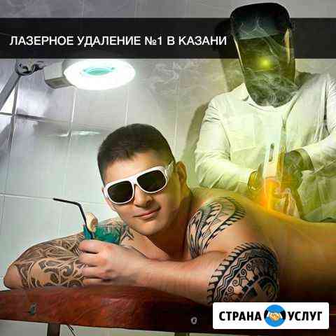 Лазерное удаление татуировок / татуажа Казань