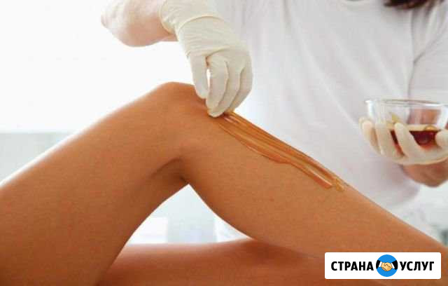 Шугаринг Череповец - изображение 1