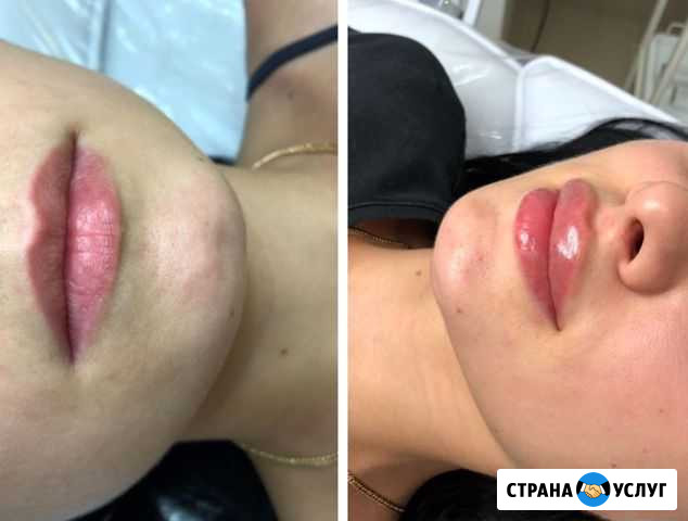Косметология, депиляция, шугаринг Ялта - изображение 1
