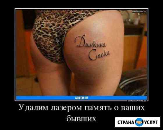 Удаляю неудачные или нежелательные татуировки Таганрог
