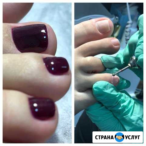 Педикюр Славянск-на-Кубани - изображение 1