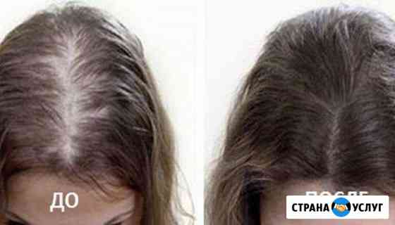 Косметолог эстет,лица тела волос-головы Иркутск