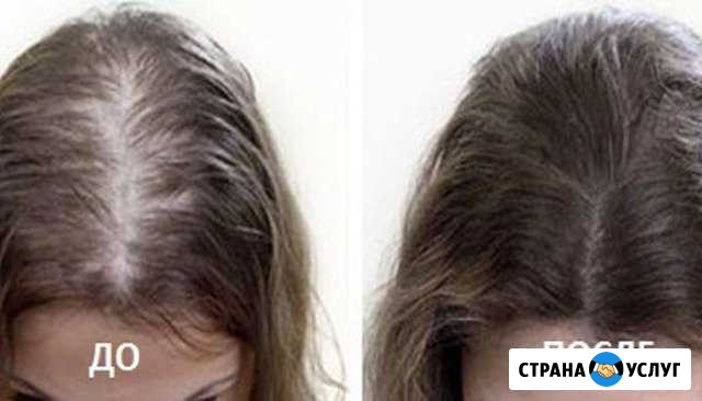 Косметолог эстет,лица тела волос-головы Иркутск - изображение 1