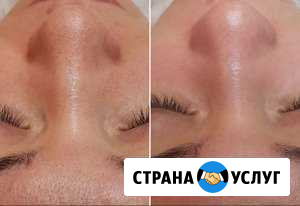 Косметолог Волгодонск - изображение 1
