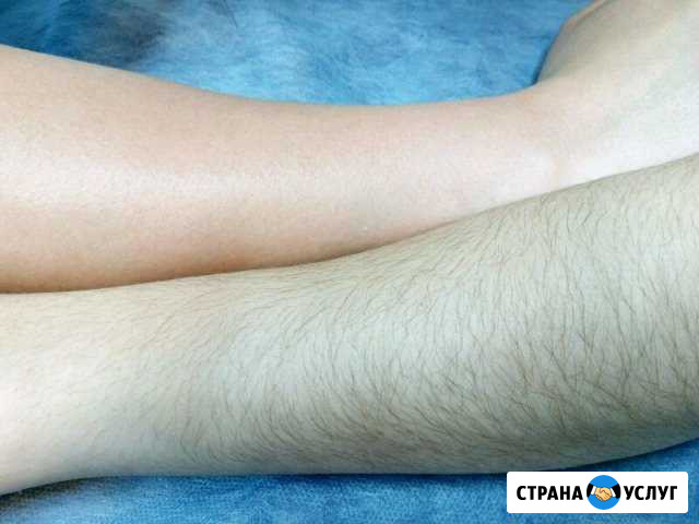 Шугаринг Батайск - изображение 1