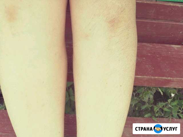 Шугаринг Бронницы - изображение 1