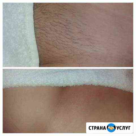 SPA-Шугаринг Люберцы