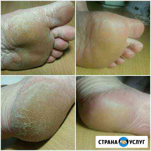 Кислотный педикюр,маникюр,покрытие shellac Ачинск