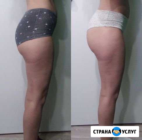 Миостимуляция Стерлитамак - изображение 1