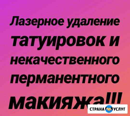 Лазерное удаление татуировок и перманентного макия Биробиджан