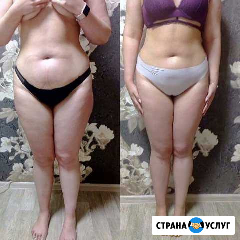 Вакуумный массаж,кавитация,РФ лифтинг, обертывание Набережные Челны - изображение 1
