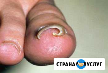 Педикюр классический Тольятти - изображение 1