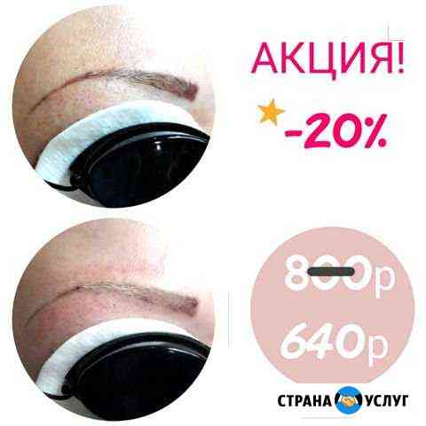 Лазерное удаление татуажа и тату Анапа