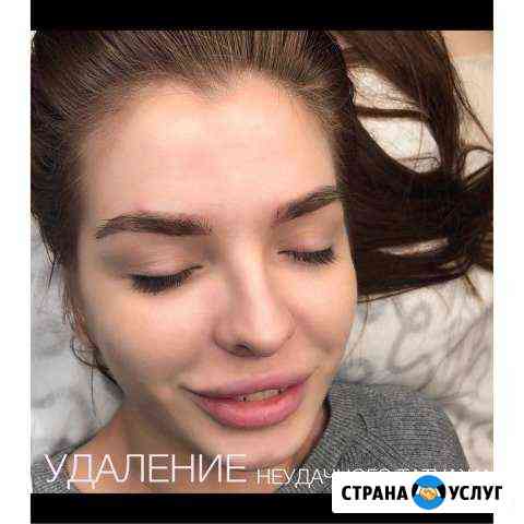 Удаление тату, старого татуажа Санкт-Петербург