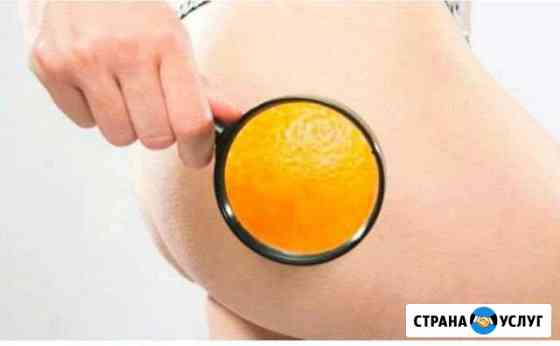 Антицеллюлитный массаж Трудобеликовский