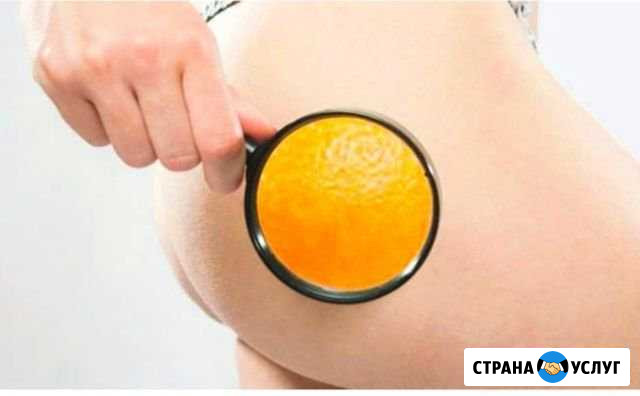 Антицеллюлитный массаж Трудобеликовский - изображение 1