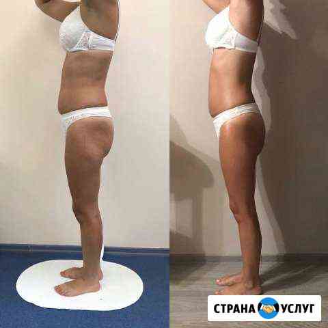 Антицилюлитный массаж вакуумный с RF лифтинг Нижний Тагил