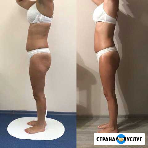 Антицилюлитный массаж вакуумный с RF лифтинг Нижний Тагил - изображение 1