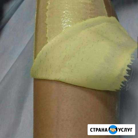 Удаление волос Новороссийск - изображение 1