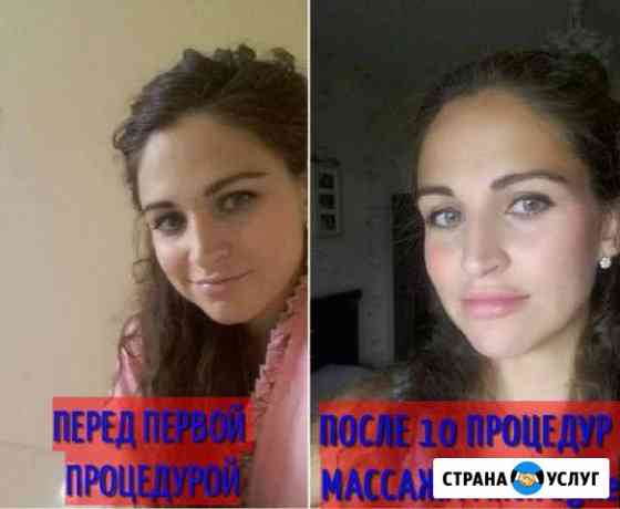 Работа с морщинами, дряблостью и отечностью Кострома