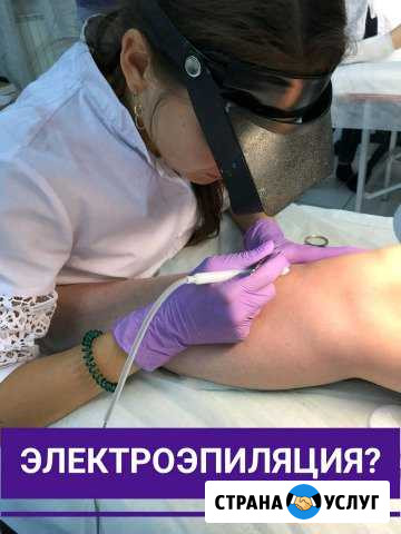 Электроэпиляция Новочеркасск - изображение 1