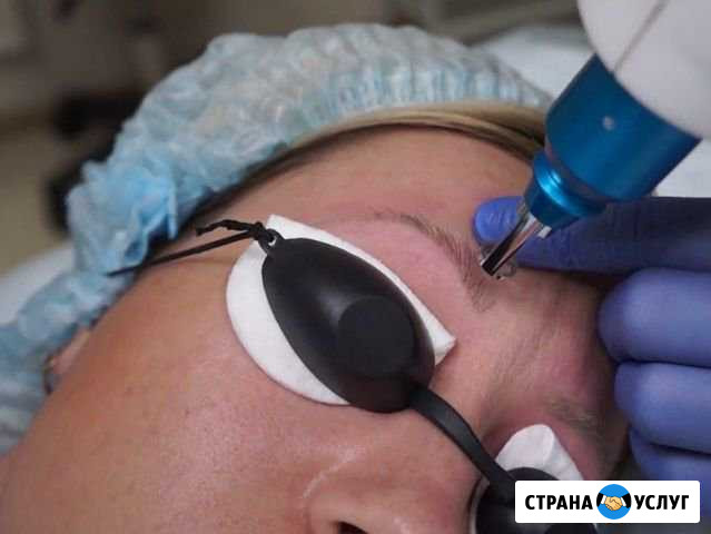 Удаление татуажа лазером Волгоград - изображение 1