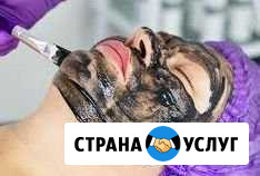 Карбоновый пилинг Волжский Волгоградской области - изображение 1