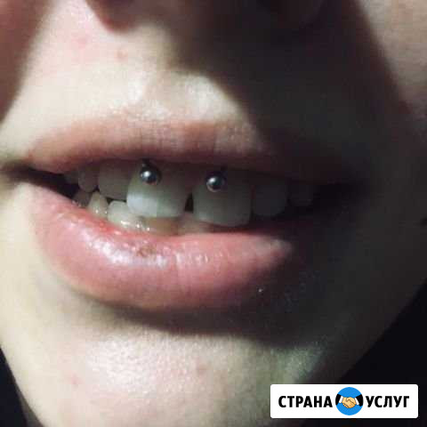 Проколы на дому Барнаул - изображение 1