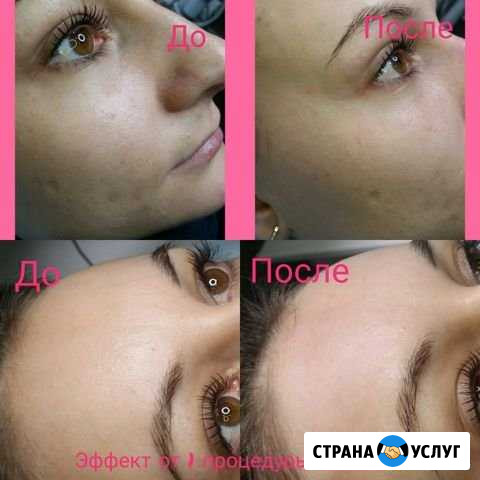 BB glow treatment - эффект тонального крема на год Дзержинск - изображение 1