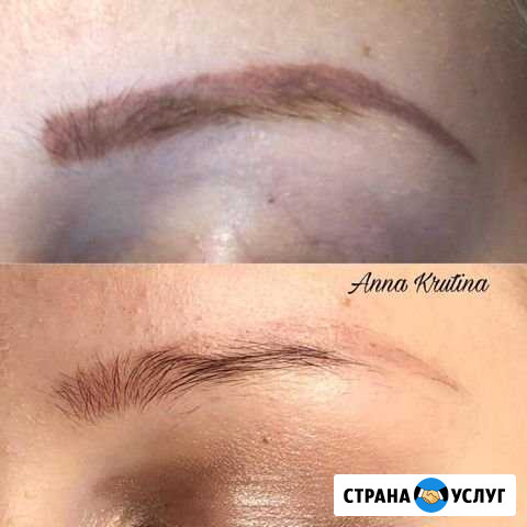 Удаление татуажа, перманентного макияжа, тату Калининград - изображение 1