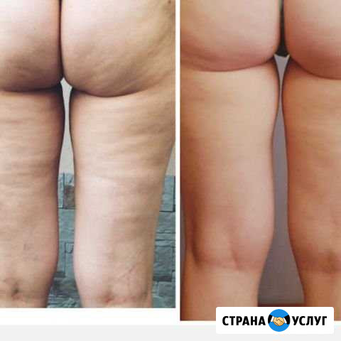 Массаж профессиональный с медицинским и высшим спо Владикавказ - изображение 1
