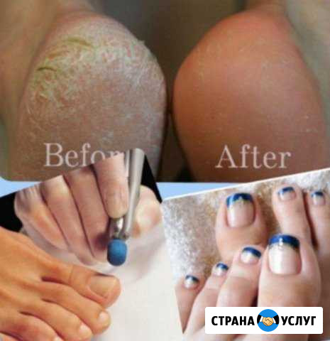 Педикюр, маникюр комбинированный Улан-Удэ - изображение 1