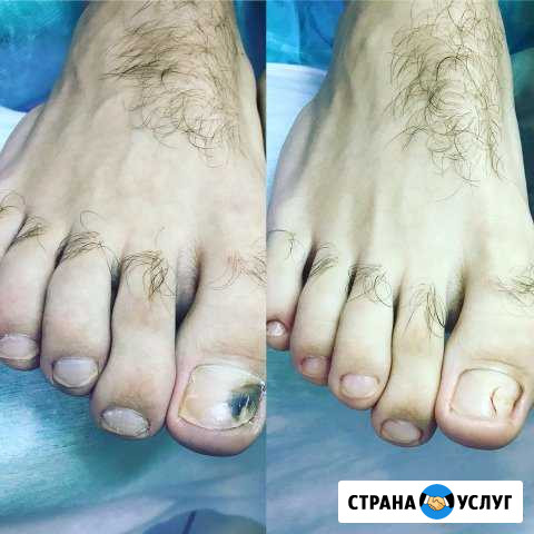 Мастер Парамедицинского Педикюра Нижний Новгород - изображение 1