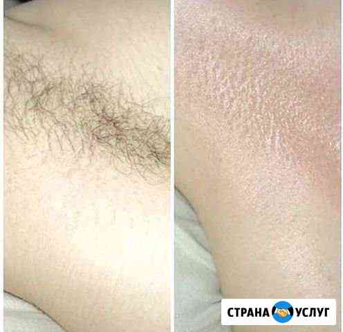 Депиляция сахаром, воском Октябрьский