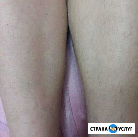Сахарная депиляция Шугаринг Хабаровск - изображение 1