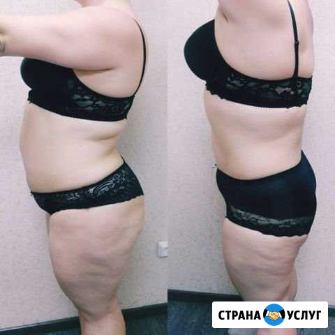 Массаж антицеллюлитный Кемерово - изображение 1