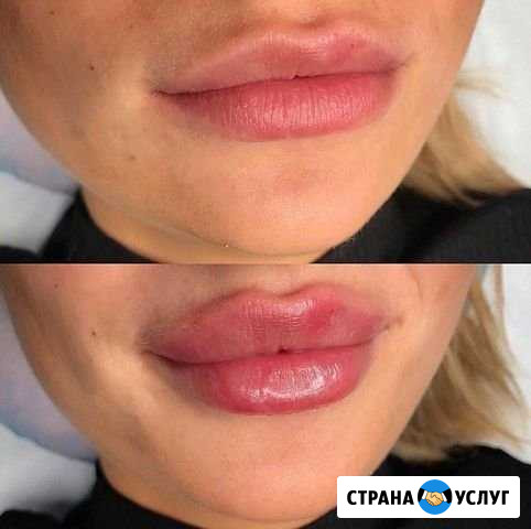 Губы Пятигорск - изображение 1
