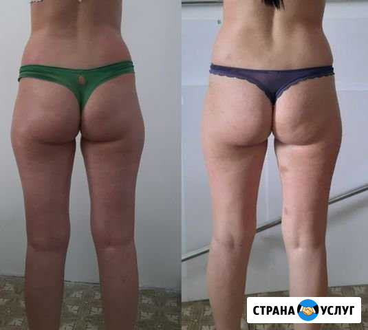 Массаж Чебоксары - изображение 1