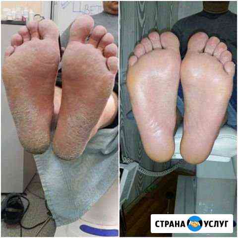 Мединский педикюр (мужской, женский, детский) Геленджик